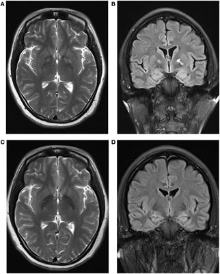 Gelsemium elegans Poisoning: A Case with 8 Months of Follow-up and Review of the Literature